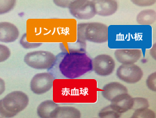 血液検査 – 県立多治見病院